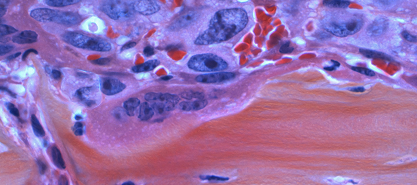 national cancer institute SP2C8o2EZBw unsplash 1